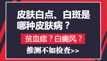 眉毛边缘变浅白了是什么病 【确诊白斑做哪些检查】