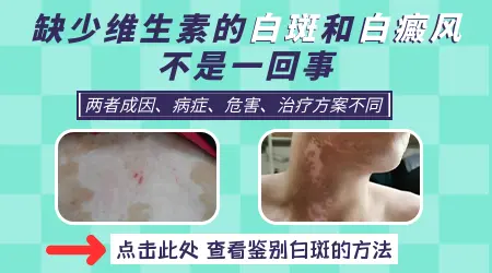 小孩缺维生素脸上白斑