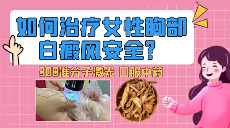 胸下面硬币大小白癜风怎么治