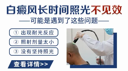手背白斑照射多大剂量合适