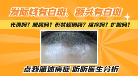 额头有一片发白是什么