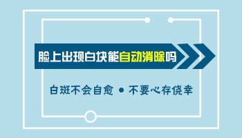 白斑长在脸上好治吗 脸部白癜风用什么方法好