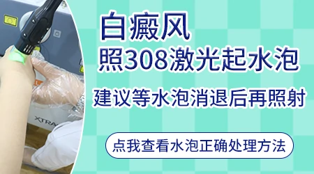 308激光治疗后起水泡几天会好