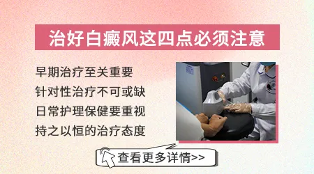 治疗白癜风的土方法有哪些