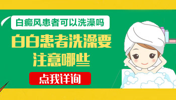 后背白癜风照完308多久可以洗澡