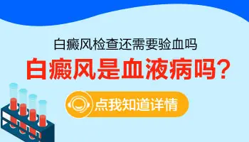 抽血检查能确诊白斑是不是白癜风吗