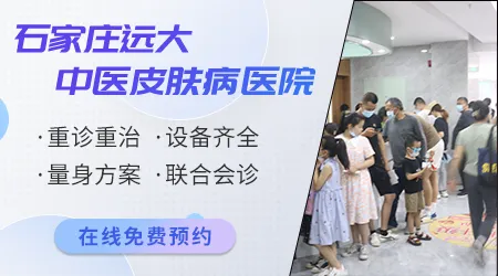 石家庄哪家医院是专业治白癜风的