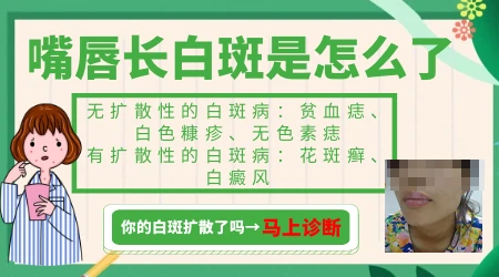 宝宝嘴巴周围白一圈怎么回事