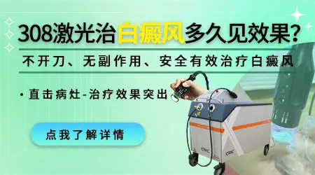 进口的308激光治疗白癜风多久见效