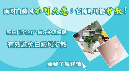 小块白癜风会不会扩散到全身