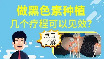 哪种类型的白癜风才能种植