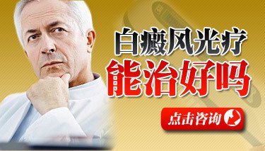 白癜风308激光多久做一次