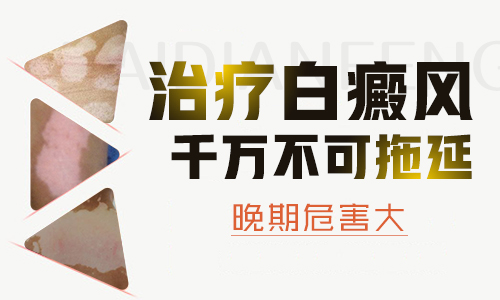 处于稳定期的白癜风不治疗可以吗