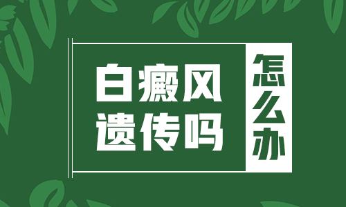 白癜风会不会遗传给孩子怎么做能彻底好