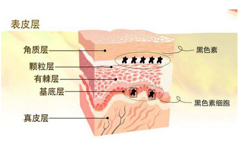 什么类型的白斑是白癜风怎么治