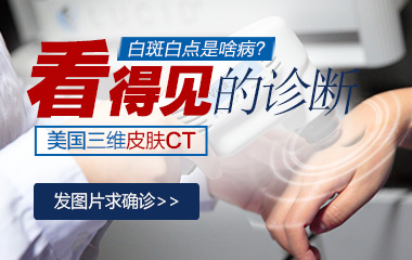 查白癜风的病因要做什么检查