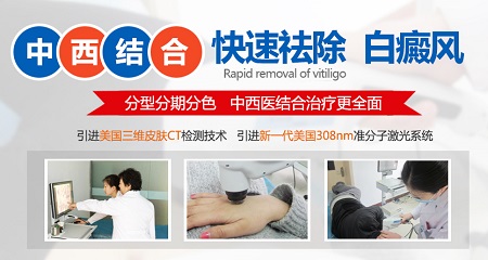 白癜风伍德灯检查瓷白色还有救吗