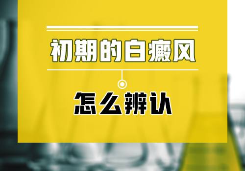 检查白癜风病因需要抽血检查吗