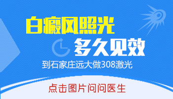 额头白癜风做多少次308激光有效果