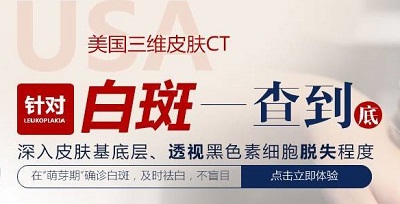 长白斑做皮肤ct大概需要多少钱