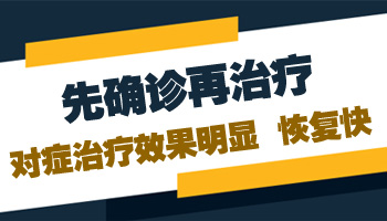 伍德灯下白斑显示浅白色是不是白癜风