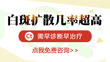 白癜风不治疗一定会扩散到全身吗