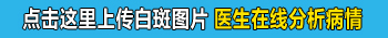 白癜风变成粉白色的了是在好转吗