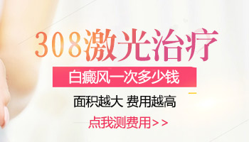 308激光照白癜风是按照什么标准收费的