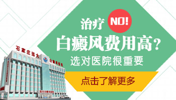 308nm准分子激光照白癜风一次多少钱