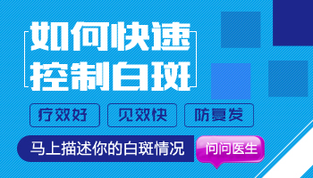 36岁嘴上长了白癜风怎么控制