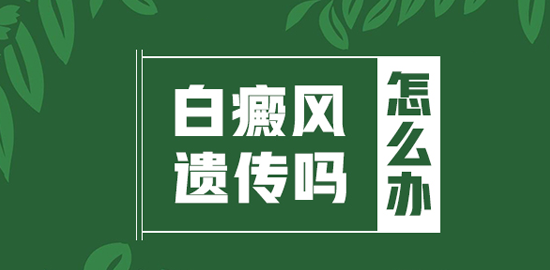 爸爸有白癜风会遗传给孩子吗