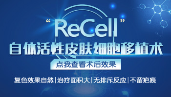 远大白癜风医院recell黑色素细胞再生术治疗图