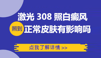 308激光照白癜风有没有时间限制