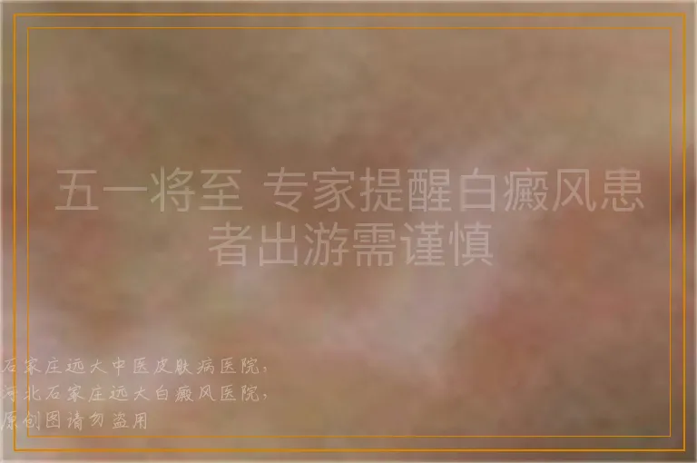 五一将至 专家提醒白癜风患者出游需谨慎