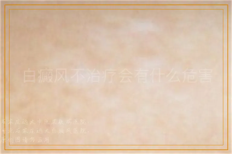 白癜风不治疗会有什么危害
