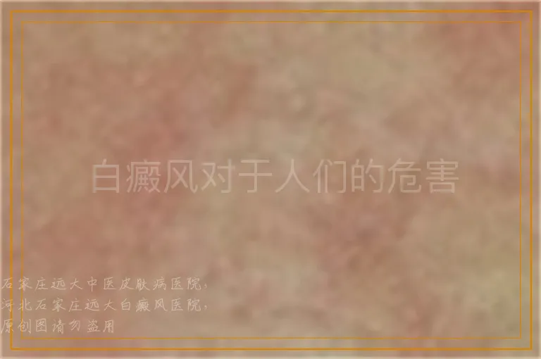 白癜风对于人们的危害