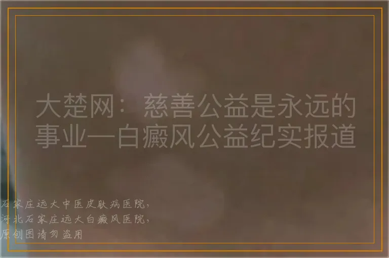 大楚网：慈善公益是永远的事业—白癜风公益纪实报道