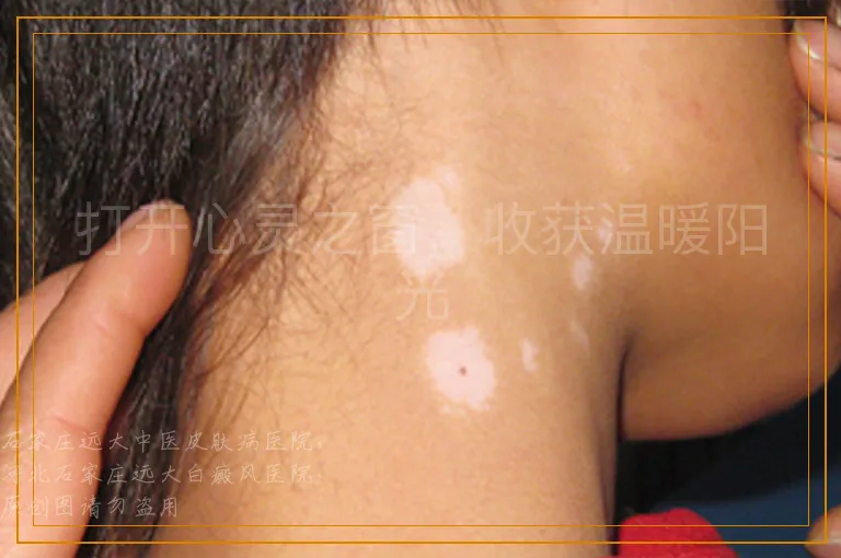 打开心灵之窗，收获温暖阳光