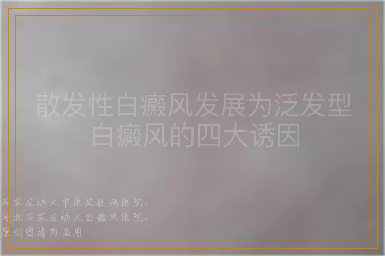 散发性白癜风发展为泛发型白癜风的四大诱因