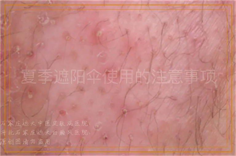 夏季遮阳伞使用的注意事项