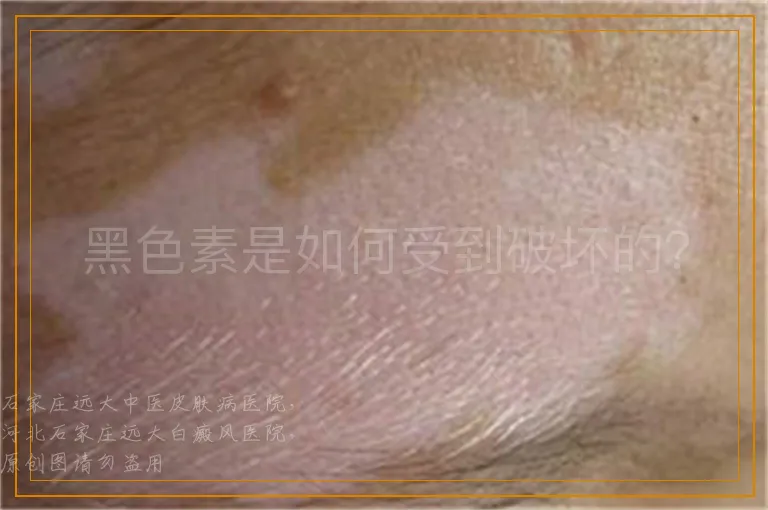 黑色素是如何受到破坏的？