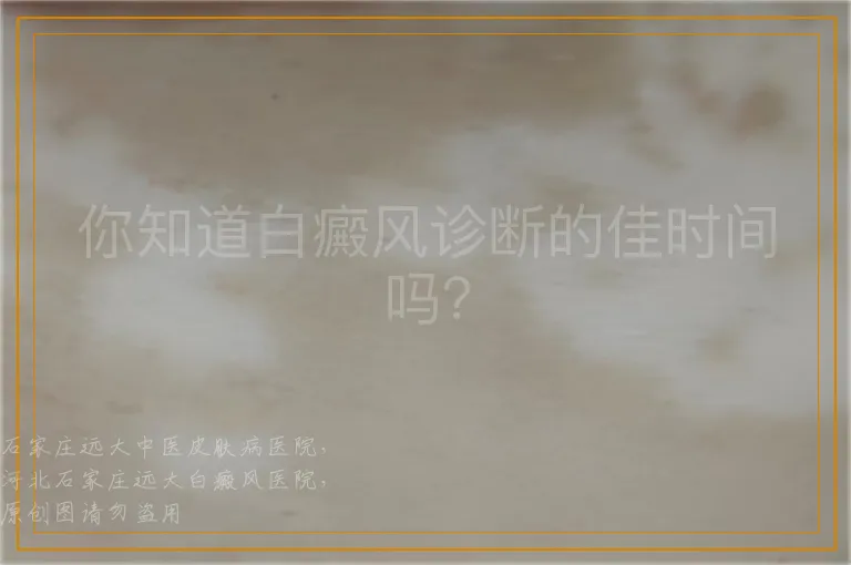 你知道白癜风诊断的佳时间吗？