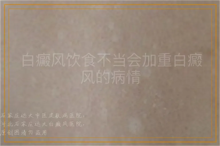 白癜风饮食不当会加重白癜风的病情