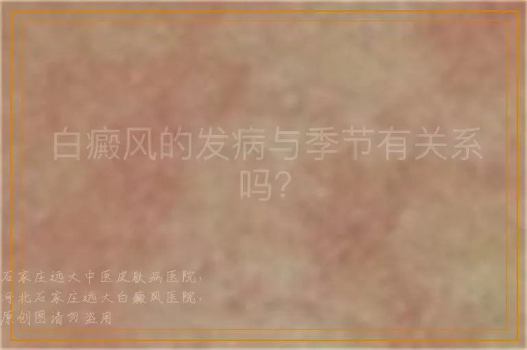 白癜风的发病与季节有关系吗？