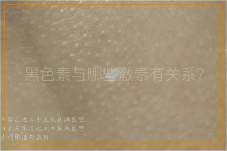 黑色素与哪些激素有关系？