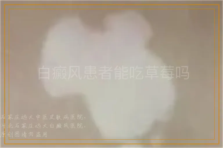 白癜风患者能吃草莓吗