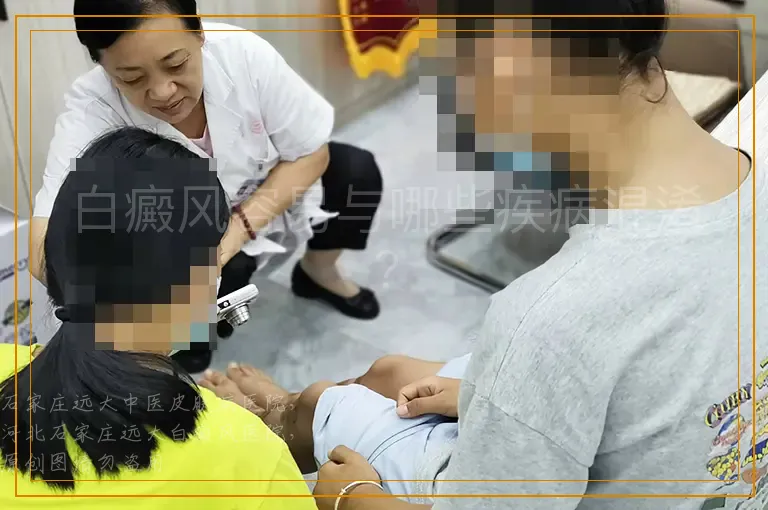 白癜风容易与哪些疾病混淆?