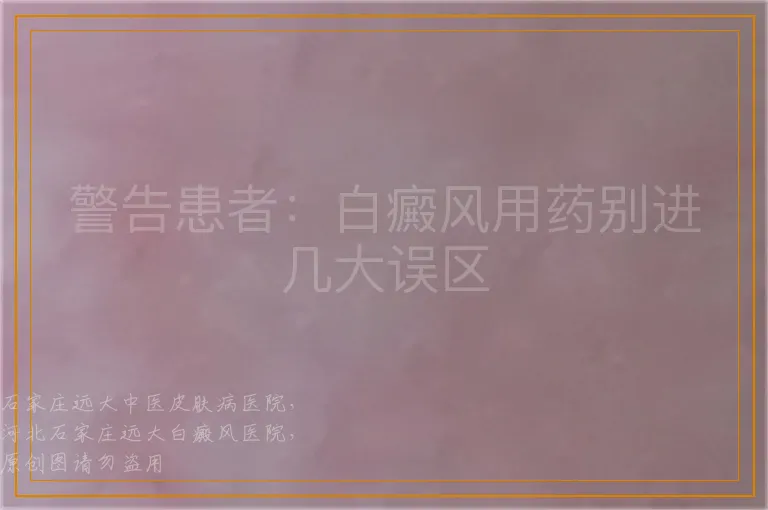 警告患者：白癜风用药别进几大误区
