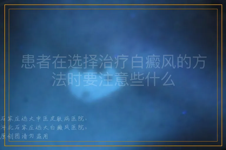 患者在选择治疗白癜风的方法时要注意些什么