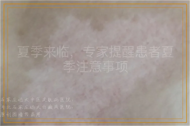 夏季来临，专家提醒患者夏季注意事项
